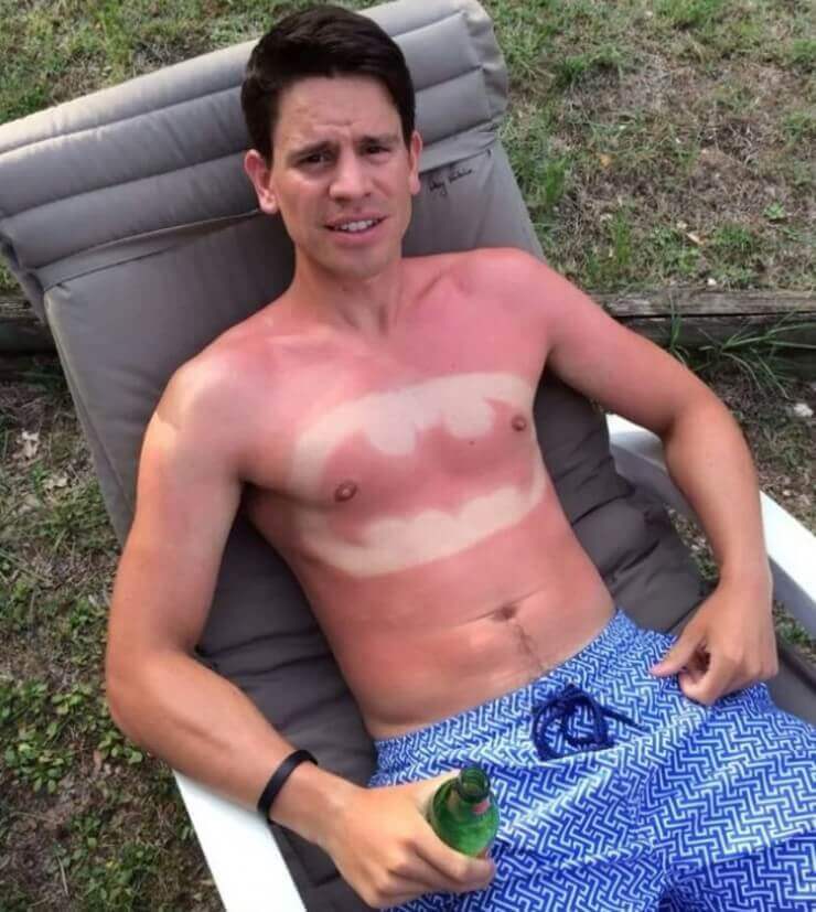 20 imagens mostrando que o sol pode ser o seu pior inimigo A prova de que o sol é o eu pior inimigo