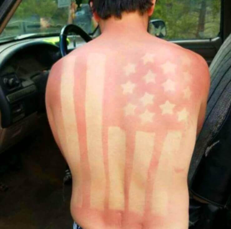 20 imagens mostrando que o sol pode ser o seu pior inimigo A prova de que o sol é o eu pior inimigo