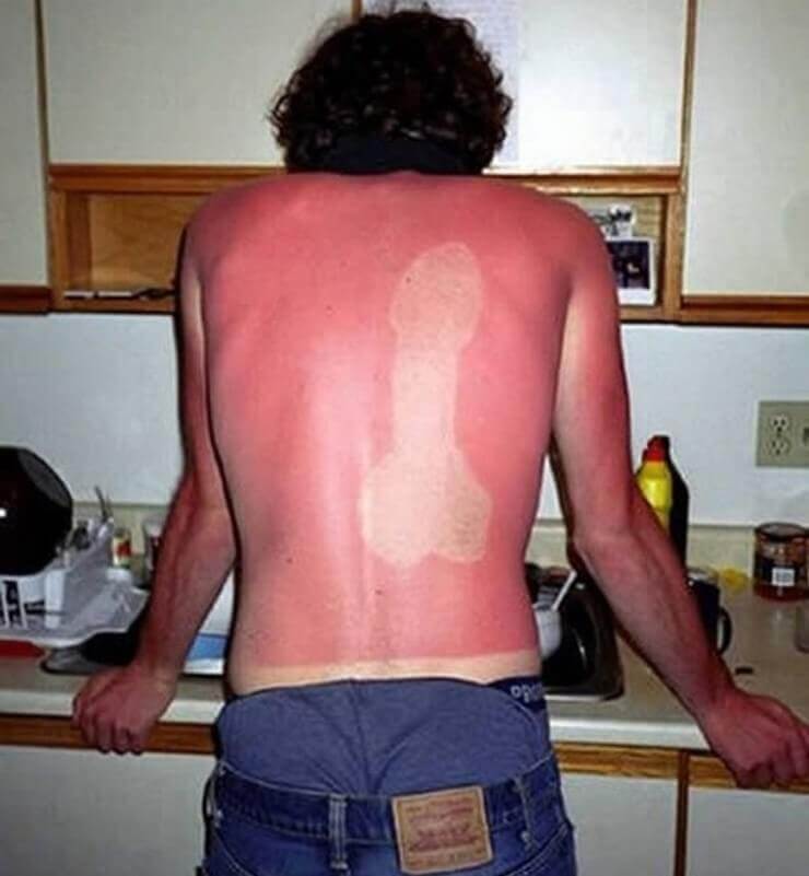 20 imagens mostrando que o sol pode ser o seu pior inimigo A prova de que o sol é o seu pior inimigo