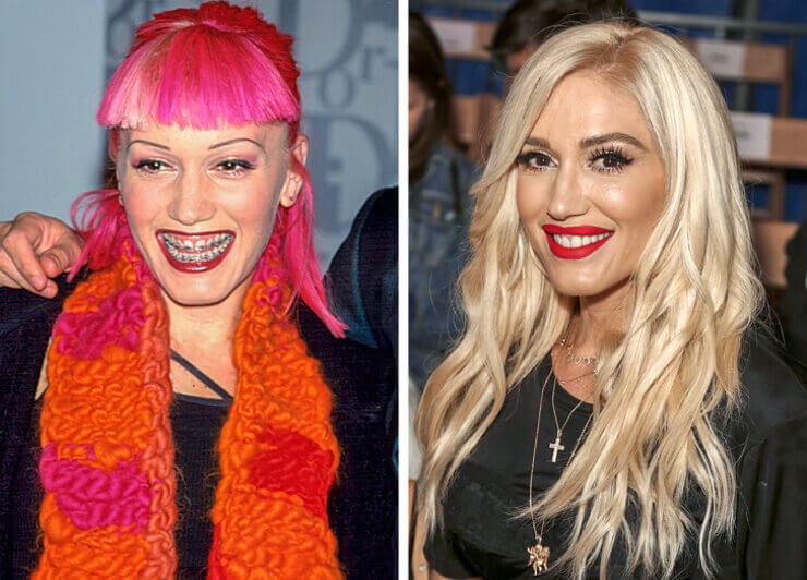 Melhores cantoras pop do mundo