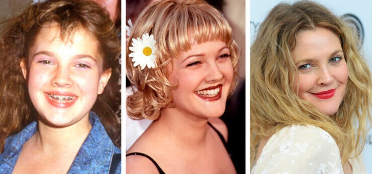 10 fotos de famosas que mostram que a beleza não depende da fama Fotos de famosas celebridades na adolescência