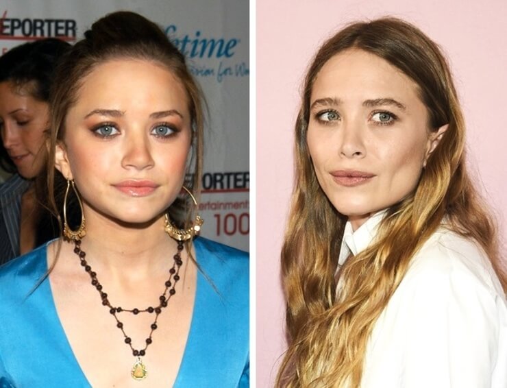 10 famosas que eram muito mais bonitas antes da cirurgia plástica Famosas que erraram feio na hora de fazer as cirurgias plásticas