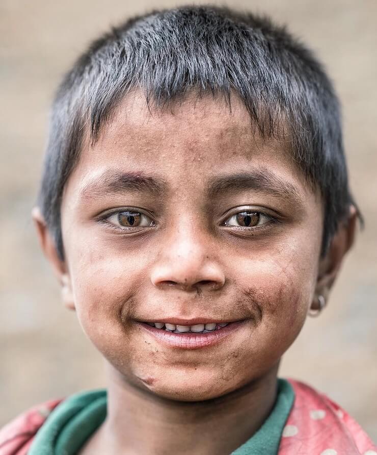 Características físicas raras que ultrapassam os padrões de beleza