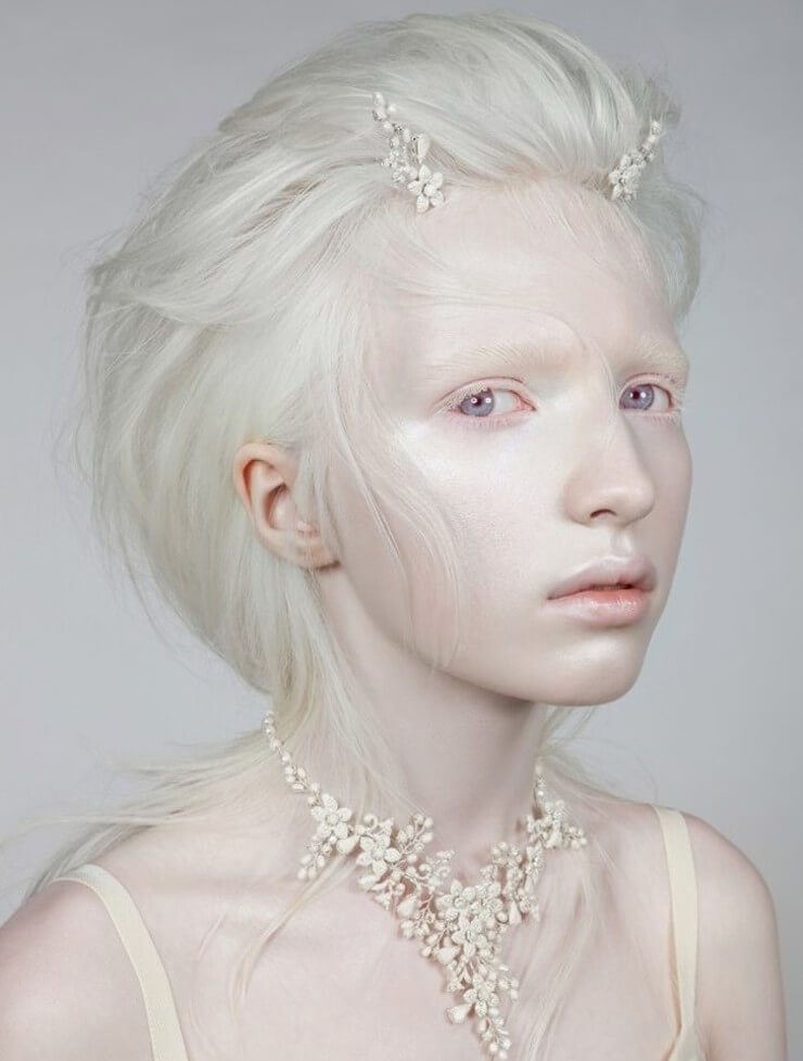 Características físicas raras que ultrapassam os padrões de beleza