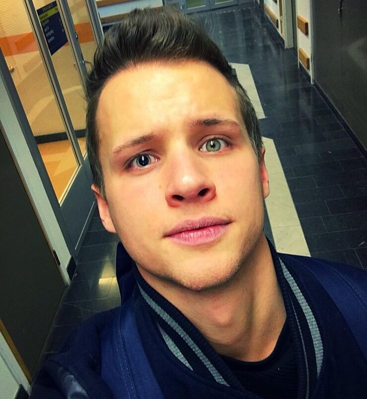 Características físicas raras que ultrapassam os padrões de beleza