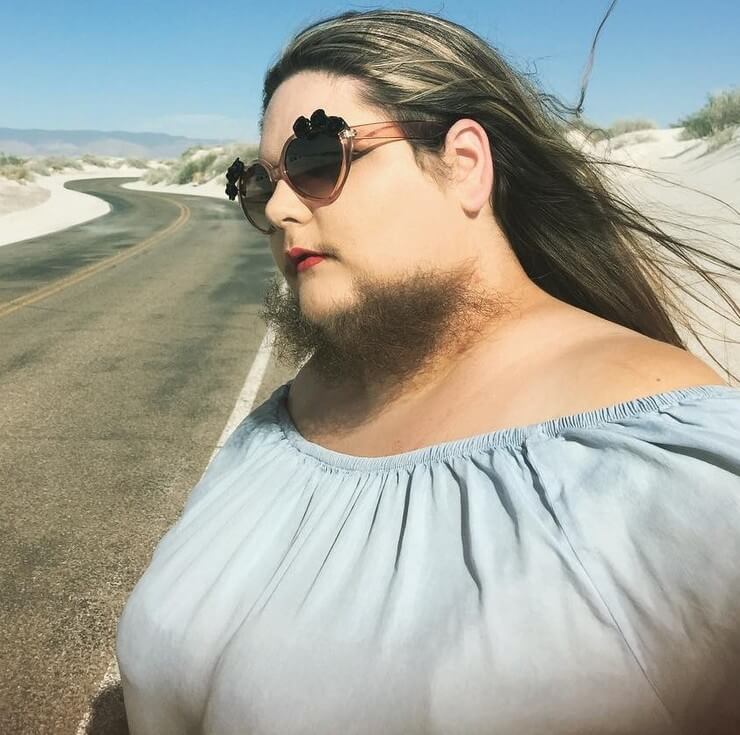 Características físicas raras que ultrapassam os padrões de beleza