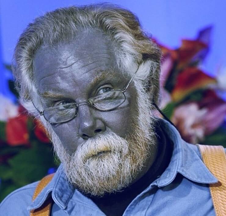 Características físicas raras que ultrapassam os padrões de beleza