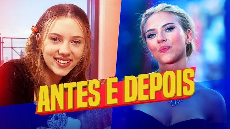 O antes e o depois das celebridades de Hollywood