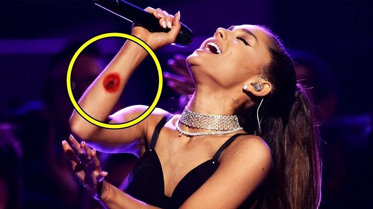 10 momentos dolorosos de famosos em apresentação para grande público Momentos dolorosos de famosos em público